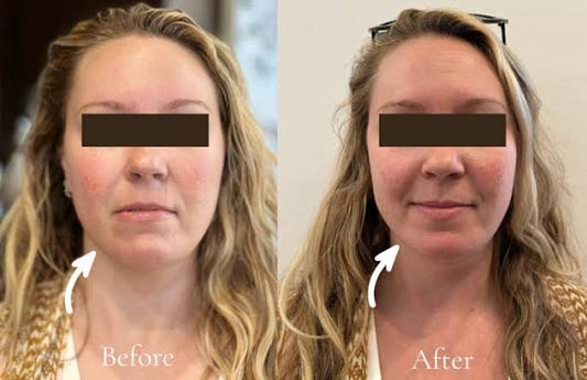 Lymphatic Massage Face Brush | Facial Sculpting & Skincare Massage Tool