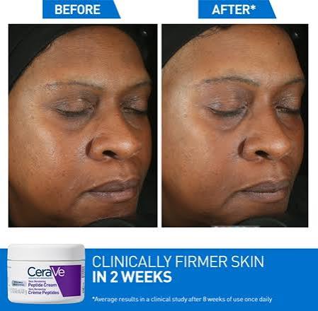 CeraVe Skin Renewing Night Cream | Overnight Hydrating Moisturizer