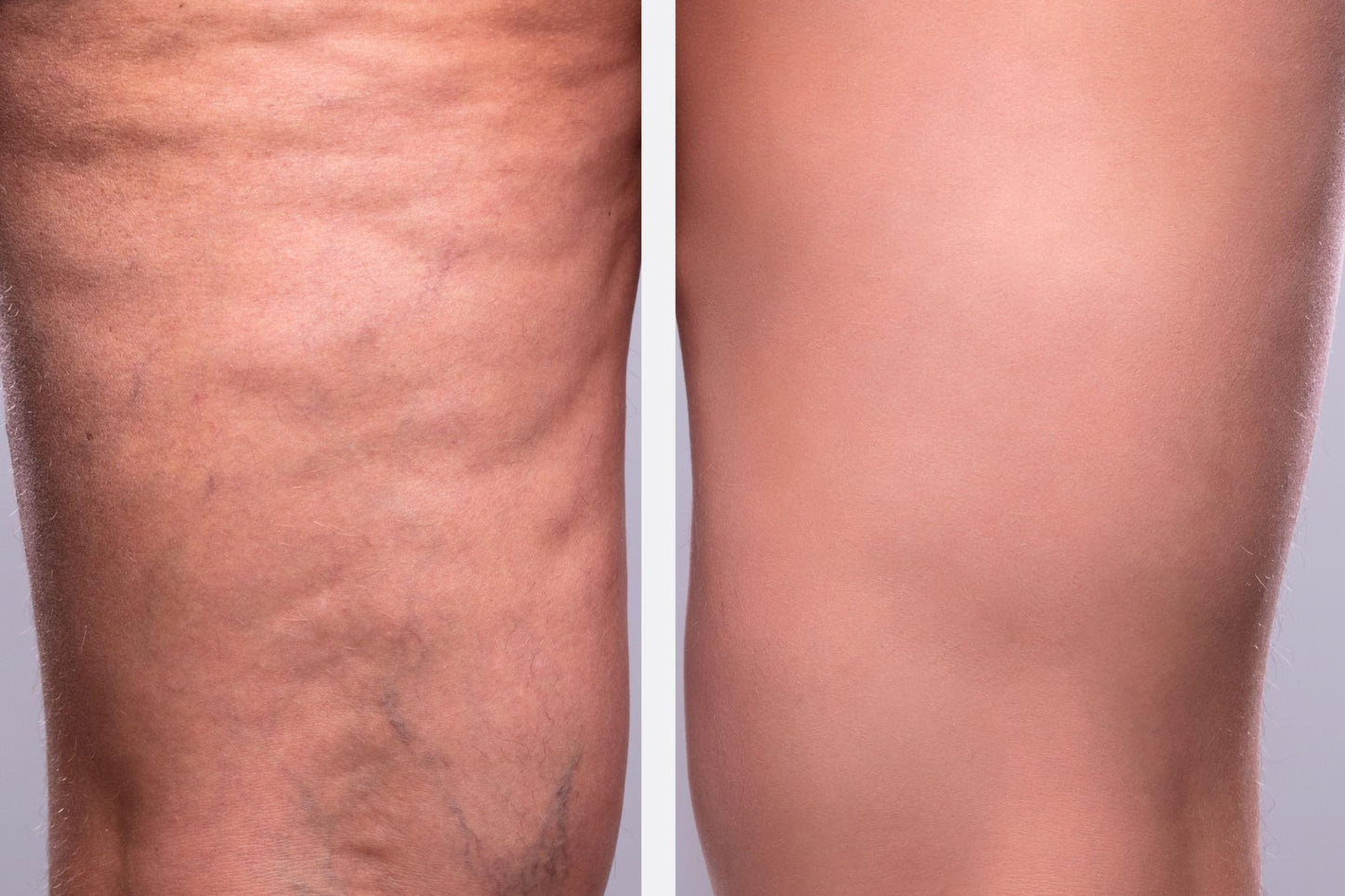 KOEC B-Tight Cream | Firming & Hydrating Moisturizer for Smoother-Looking Skin