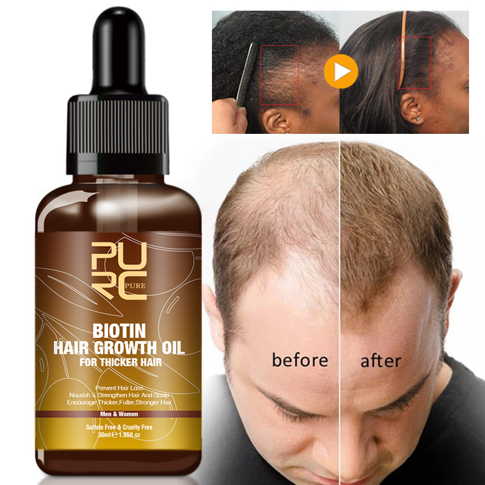 Puro Biotin Hair Care Set – Shampoo, Conditioner & Hair Oil