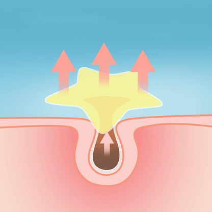 Hydrocolloid Acne Patches | Invisible Blemish Patches for Clear-Looking Skin
