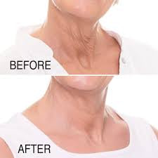 Moika Tighten & Lift Neck Cream | Firming Hydration for Neck & Décolleté