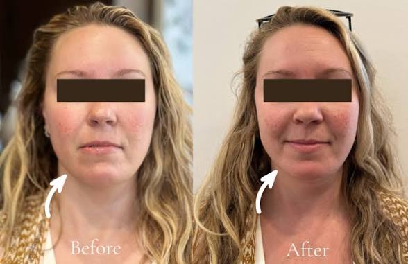 Lymphatic Massage Face Brush | Facial Sculpting & Skincare Massage Tool