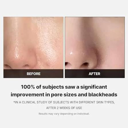 Medicube Zero Pore Pads | Exfoliating Toner Pads for Smooth-Looking Skin