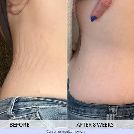 GoPure Tighten & Smooth Belly Cream | Firming Body Moisturizer