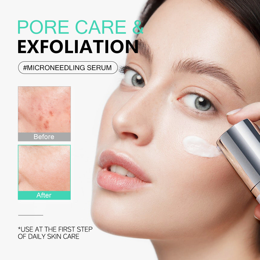 KOEC Cica Centella Microneedling Serum | Soothing & Skin Barrier Care