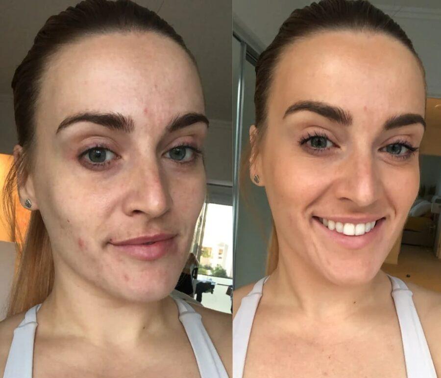 KOEC BB Cream | Lightweight Hydrating Full Coverage BB Cream